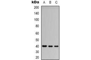 Western blot analysis of CD32b expression in Jurkat (A), SHSY5Y (B), HEK293T (C) whole cell lysates. (FCGR2B antibody  (C-Term))