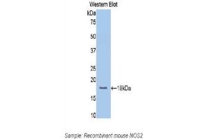 Detection of Recombinant NOS2, Mouse using Polyclonal Antibody to Nitric Oxide Synthase 2, Inducible (NOS2) (NOS2 antibody  (AA 526-659))
