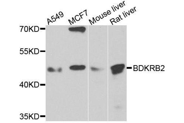 BDKRB2 antibody  (AA 302-391)