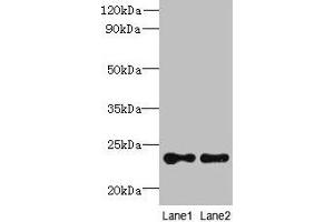 Western blot All lanes: TMED2 antibody at 6 μg/mL Lane 1: HCT116 whole cell lysate Lane 2: Mouse ovarian tissue Secondary Goat polyclonal to rabbit IgG at 1/10000 dilution Predicted band size: 23 kDa Observed band size: 23 kDa (TMED2 antibody  (AA 26-111))