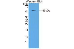 Western blot analysis of recombinant Rat a1AGP.