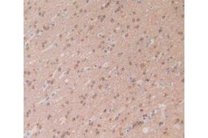 IHC-P analysis of Human Brain Tissue, with DAB staining. (CRYAB antibody  (AA 1-175))