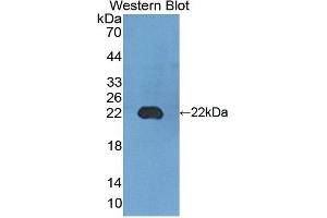 Figure. (EMR2 antibody  (AA 347-509))