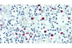 Immunohistochemistry of paraffin-embedded Thymus tissue using SRGN Polyclonal Antibody at dilution of 1:100. (SRGN antibody)