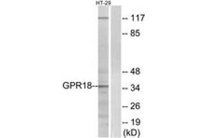 Western blot analysis of extracts from HT-29 cells, using GPR18 Antibody. (GPR18 antibody  (AA 131-180))