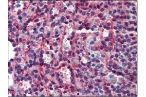 Immunohistochemistry (IHC) image for anti-Caspase 7, Apoptosis-Related Cysteine Peptidase (CASP7) antibody (ABIN614356) (Caspase 7 antibody)