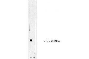 Image no. 1 for anti-Protein Phosphatase 1, Catalytic Subunit, alpha Isoform (PPP1CA) (AA 317-330), (C-Term), (Catalytic Subunit) antibody (ABIN264931) (PPP1CA antibody  (C-Term, Catalytic Subunit))