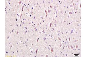 Formalin-fixed and paraffin embedded rat brain tissue labeled with Anti-LRP5 + LRP6 Polyclonal Antibody, Unconjugated (ABIN681478) at 1:200 followed by conjugation to the secondary antibody and DAB staining (LRP5 antibody  (AA 451-550))