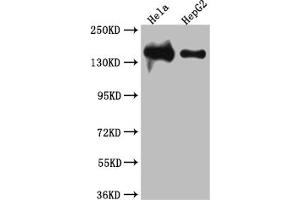 Western Blot Positive WB detected in: Hela whole cell lysate, HepG2 whole cell lysate All lanes: DNA Ligase I antibody at 1:1000 Secondary Goat polyclonal to rabbit IgG at 1/50000 dilution Predicted band size: 102, 89, 99 kDa Observed band size: 140 kDa (Recombinant LIG1 antibody)