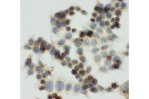 Immunohistochemistry (IHC) image for anti-Insulin-Like Growth Factor 2 Receptor (IGF2R) (AA 2475-2491), (C-Term) antibody (ABIN3044000)