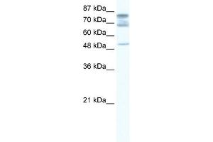 DDX46 antibody used at 1.