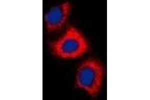 Immunofluorescent analysis of Recoverin staining in HeLa cells. (Recoverin antibody)