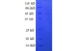 SDS-PAGE (SDS) image for General Transcription Factor IIF, Polypeptide 2, 30kDa (GTF2F2) (AA 2-249) protein (His-SUMO Tag) (ABIN5709627)