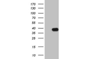 Western Blotting (WB) image for anti-Insulin-Like Growth Factor Binding Protein 1 (IGFBPI) (AA 26-259) antibody (ABIN2676854) (IGFBPI antibody  (AA 26-259))