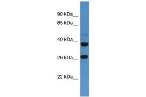 Western Blotting (WB) image for anti-Somatostatin Receptor 2 (SSTR2) (C-Term) antibody (ABIN2505939) (SSTR2 antibody  (C-Term))