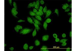 Immunofluorescence of monoclonal antibody to XAB1 on HeLa cell. (GPN1 antibody  (AA 9-118))