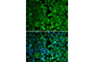 Immunofluorescence analysis of MCF-7 cells using RUNX3 antibody (ABIN6130682, ABIN6147314, ABIN6147315 and ABIN6223139). (RUNX3 antibody  (AA 210-429))