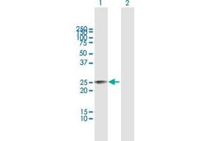 Western Blot analysis of MPZL3 expression in transfected 293T cell line by MPZL3 MaxPab polyclonal antibody. (MPZL3 antibody  (AA 1-235))