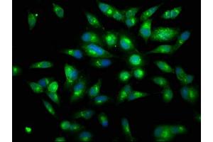 Immunofluorescence staining of Hela cells with ABIN7134517 at 1:150, counter-stained with DAPI. (Lactoferrin antibody)