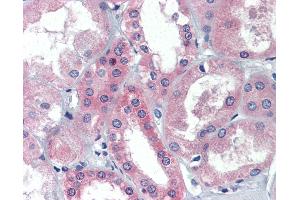 Anti-BRCC3 / BRCC36 antibody IHC of human kidney.