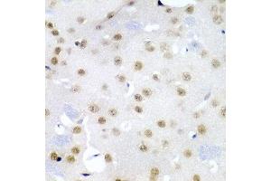 Immunohistochemistry of paraffin-embedded mouse brain using CDC27 antibody at dilution of 1:200 (40x lens). (CDC27 antibody)