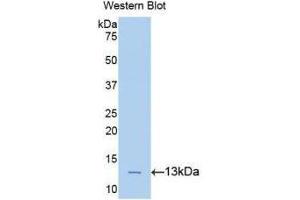 Western blot analysis of the recombinant protein. (PLAA antibody  (AA 367-468))