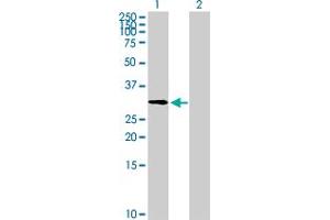 Western Blot analysis of ZNF511 expression in transfected 293T cell line by ZNF511 MaxPab polyclonal antibody.