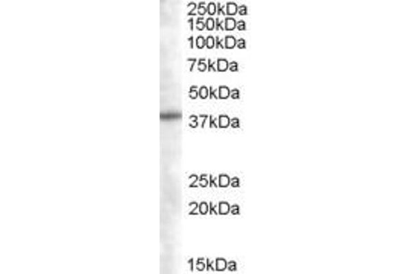 SNX16 anticorps  (N-Term)