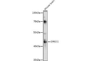 Western blot analysis of extracts of various cell lines, using GPR151 antibody (ABIN7267296) at 1:1000 dilution. (GPR151 antibody  (AA 310-419))
