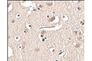 Immunohistochemistry of Slitrk2 in human brain tissue with this product at 2. (SLITRK2 antibody  (Middle Region))