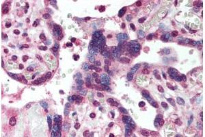 Human Placenta (formalin-fixed, paraffin-embedded) stained with SMAD2 antibody ABIN293877 at 5 ug/ml followed by biotinylated goat anti-rabbit IgG secondary antibody ABIN481713, alkaline phosphatase-streptavidin and chromogen. (SMAD2 antibody  (AA 234-249))