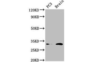 Western Blot Positive WB detected in: PC-3 whole cell lysate, Mouse brain tissue All lanes: HOXD8 antibody at 4. (HOXD8 antibody  (AA 59-108))