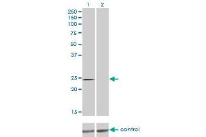 Western blot analysis of QDPR over-expressed 293 cell line, cotransfected with QDPR Validated Chimera RNAi (Lane 2) or non-transfected control (Lane 1). (QDPR antibody  (AA 1-244))