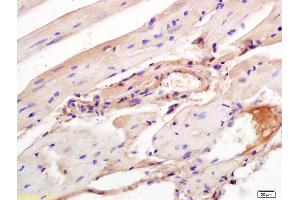 Formalin-fixed and paraffin embedded mouse heart labeled with Rabbit Anti Aggrecanase-2/ADAMTS5 Polyclonal Antibody, Unconjugated (ABIN701005) at 1:200 followed by conjugation to the secondary antibody and DAB staining (ADAMTS5 antibody  (AA 511-610))