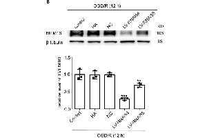 Western Blotting (WB) image for anti-Anoctamin 6 (ANO6) (AA 744-824) antibody (ABIN7436141)