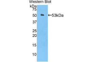 Western blot analysis of the recombinant protein. (ANGPTL3 antibody  (AA 237-455))