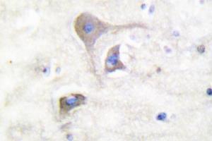 Image no. 2 for anti-Synuclein, beta (SNCB) antibody (ABIN271836) (beta Synuclein antibody)