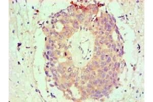 Immunohistochemical of paraffin-embedded Human endometrium tissue using ABIN7145293 at dilution of 1:200 (BCL2L1 antibody)