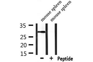 Western blot analysis of extracts from mouse spleen, using POMC Antibody. (POMC antibody  (C-Term))