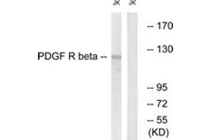 Western blot analysis of extracts from Jurkat cells, treated with TNF-a 20ng/ml 5', using PDGFR beta (Ab-740) Antibody. (PDGFRB antibody  (AA 711-760))