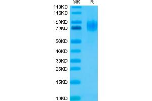 Human EGFRVIII on Tris-Bis PAGE under reduced condition. (EGFRviii Protein (His-Avi Tag))