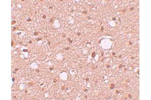Immunohistochemical staining of human brain cells with APBA2 polyclonal antibody  at 10 ug/mL. (APBA2 antibody  (Internal Region))