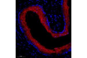 Immunofluorescence of paraffin embedded mouse esophagus using SPRR3 (ABIN7075637) at dilution of 1:2000 (300x lens) (SPRR3 antibody)