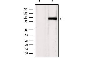Western blot analysis of extracts from HepG2, using IFT88 antibody.