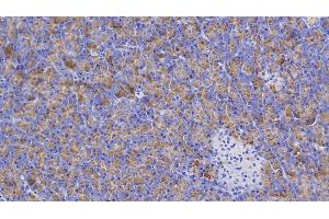 Detection of AMY1A in Human Pancreas Tissue using Polyclonal Antibody to Salivary Alpha Amylase (AMY1A) (Salivary Amylase alpha (AA 15-511) antibody)
