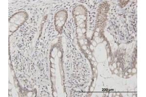 Image no. 4 for anti-C1D Nuclear Receptor Corepressor (C1D) (AA 1-142) antibody (ABIN599137) (C1D antibody  (AA 1-142))
