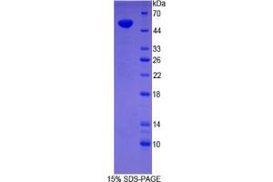 SDS-PAGE analysis of Human Synaptopodin Protein.