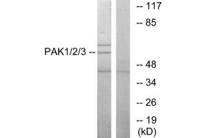 Western Blotting (WB) image for anti-P21-Activated Kinases 1/2/3 (PAK1/2/3) (Thr402), (Thr421), (Thr423) antibody (ABIN1847964) (PAK1/2/3 antibody  (Thr402, Thr421, Thr423))
