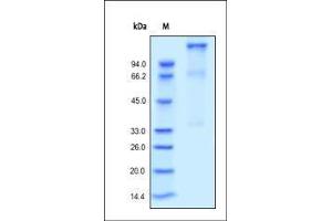 IGF1R Protein (AA 31-932) (His tag)