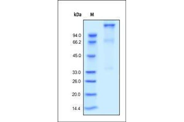 IGF1R Protein (AA 31-932) (His tag)